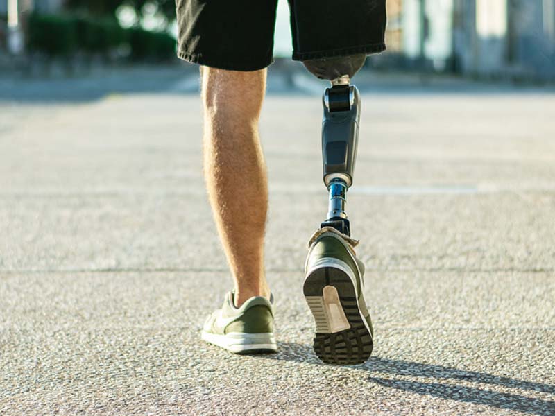 Man with prosthetic leg walking